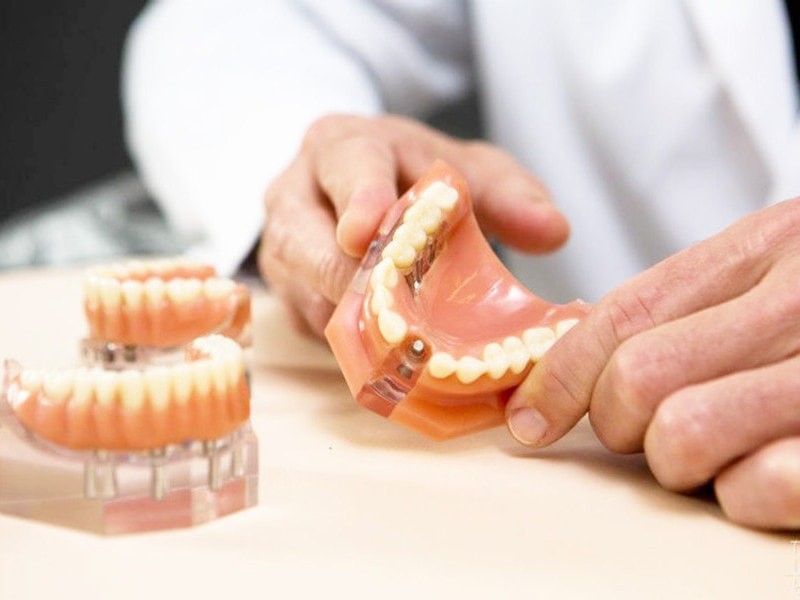 Протезирование зубов в стоматологии.
