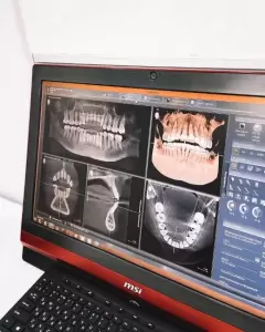 Фотография Гутен Таг 3